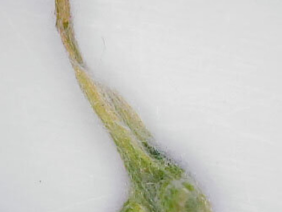 Part of bur containing seeds